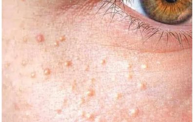 VITAMIN KULIT CANTIK