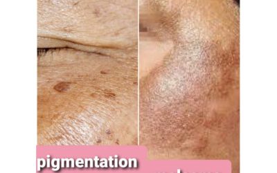 PETUA HILANGKAN JERAGAT