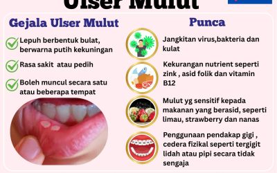 Ulser mulut dan lidah